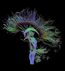 Image de tractographie. Des fibres sont visibles dans une vue tridimensionnelle du cerveau.