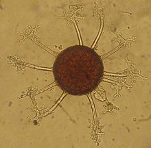 Une sphère brune entourée de sortes de polypes transparents