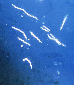  Borrelia burgdorferi, en microscopie à fond noir, spirochète grossit 400 fois, l'agent responsable de la maladie de Lyme