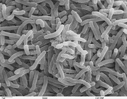  Vibrio cholerae, microscopie électronique