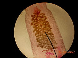  Clonorchis sinensis observé au microscope