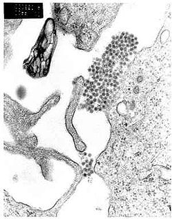  Le virus de la dengue, un Flavivirus au microscope électronique