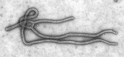  Virus d'Ebola (au microscope électronique en transmission)