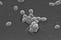  Enterococcus faecalis(microscopie électronique à balayage)