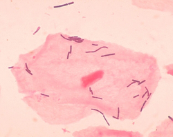  Lactobacillus acidophilus sur des squames de cellules épithéliales du vagin
