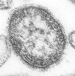  Un Morbillivirus, le virus de la rougeole