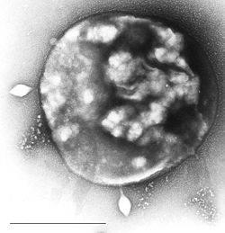  Archée du genre Sulfulobus infectée avec le virus STSV-1