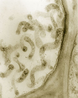  Mycoplasma (Spiroplasma,bactérie motile caractérisé par une forme hélicoïdale)