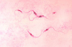  Trypanosoma cruzi responsable de la maladie de Chagas