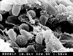  Un groupe de bactéries Yersinia pestis observé au microscope électronique
