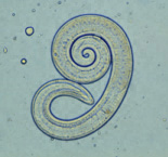  Larve de Trichinella spiralis